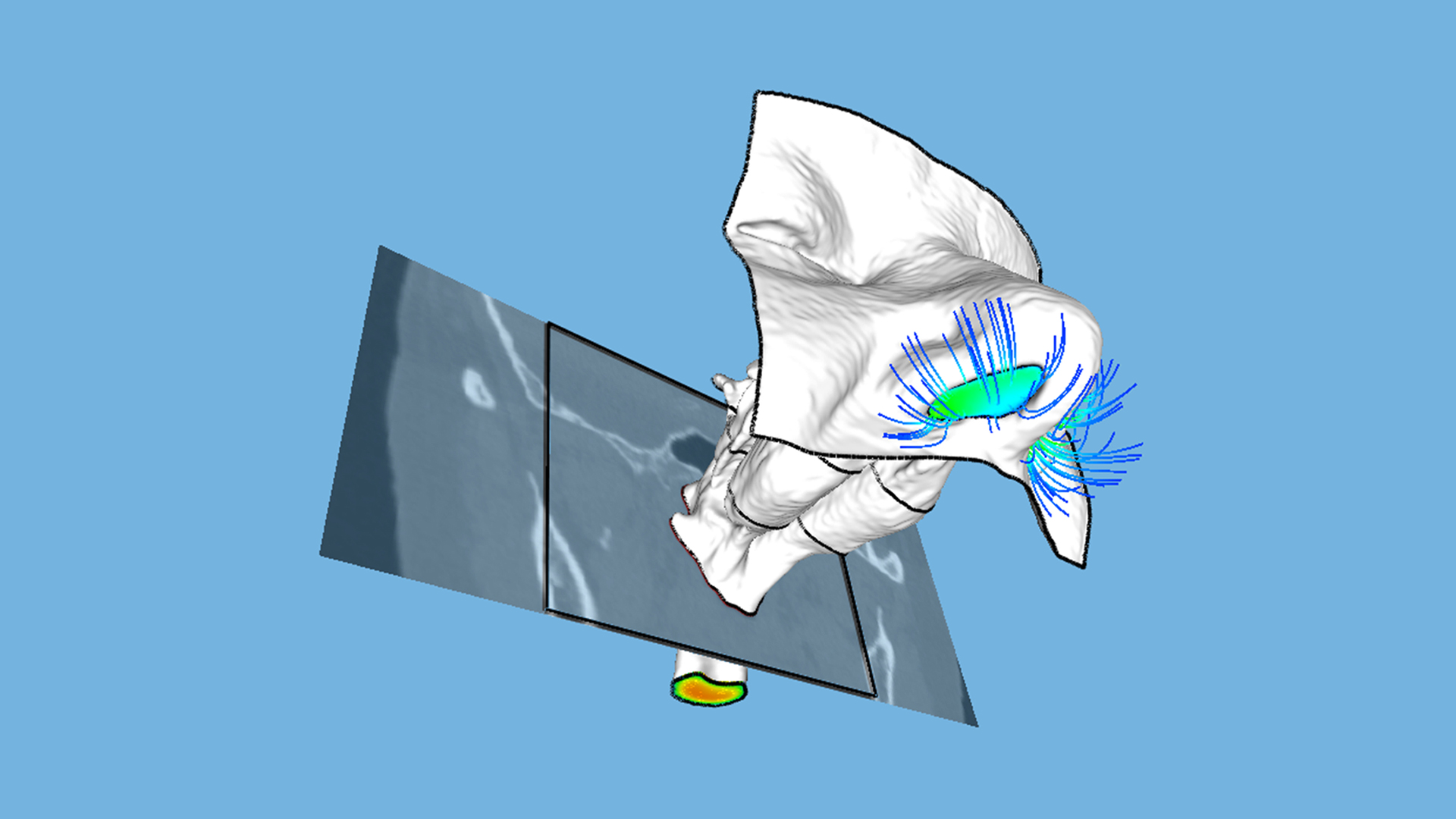 Why is CFD technology important in ENT practice?