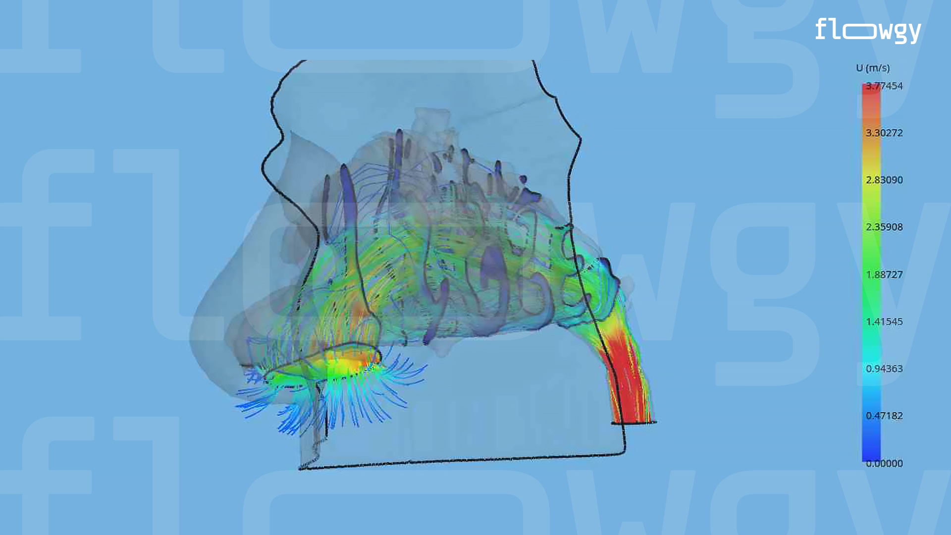 Representation of the airflow in the nasal cavity through streamlines.