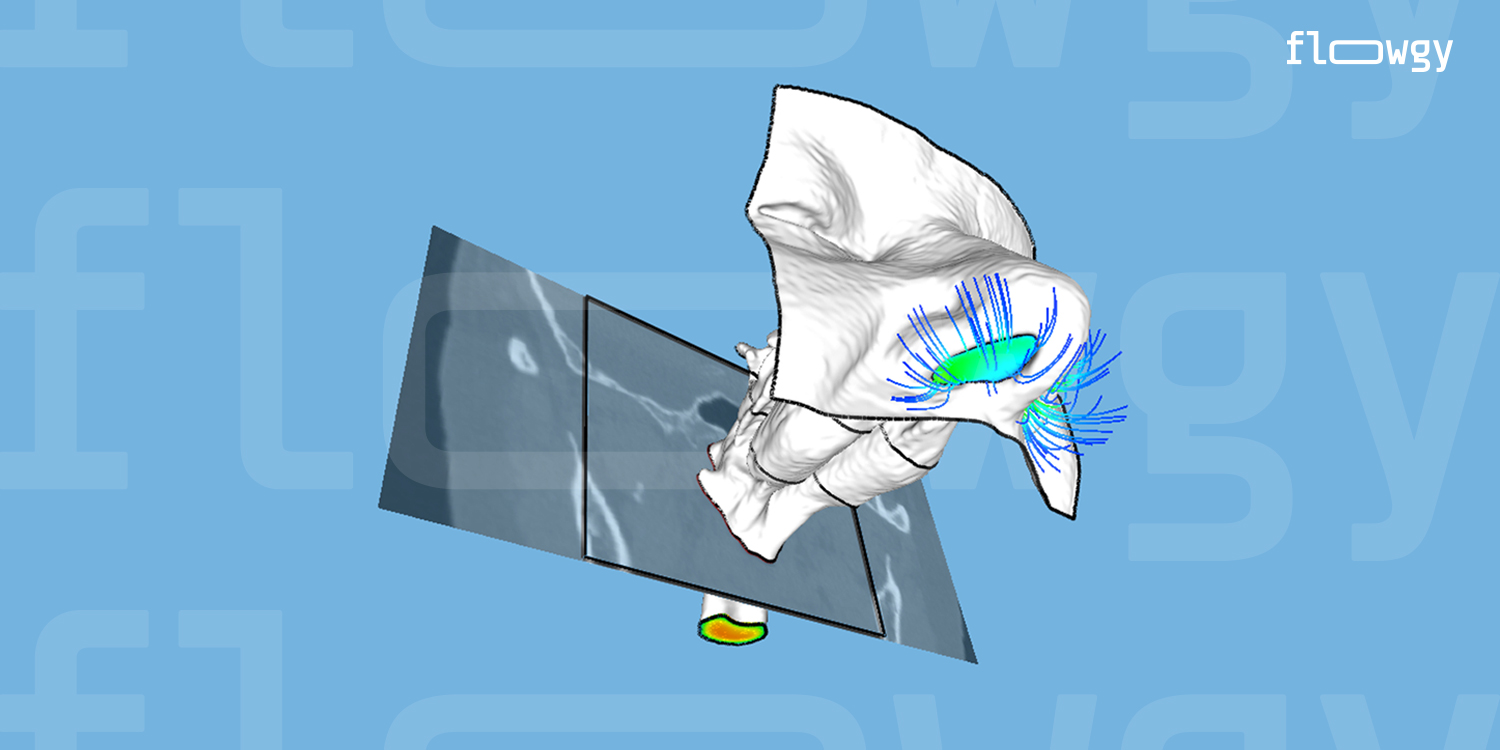 Why is CFD technology important in ENT practice?