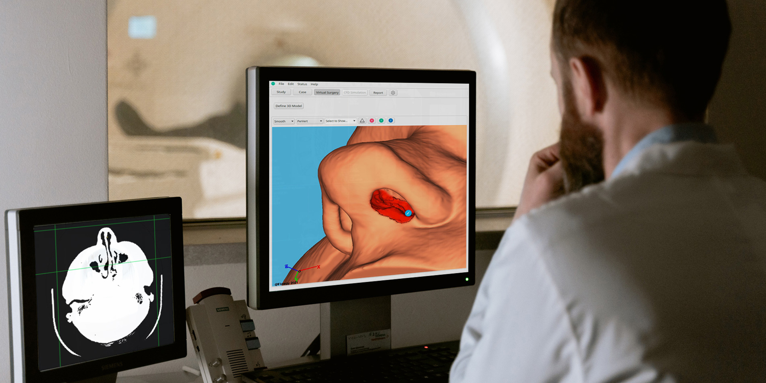Virtual surgery: the revolution of nasal surgery in the ENT world by Flowgy.